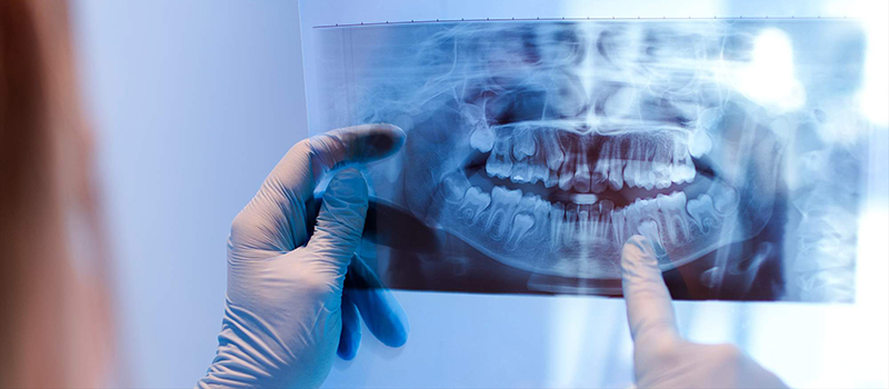 Cirug�a maxilofacial | Maxilofacial Zaragoza | Dra. M�nica Lafont